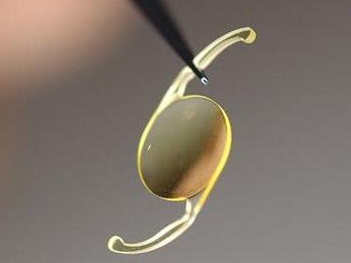 低温日皮视频APP下载安装技术提高人工晶状体的亲水性，解决术后炎症问题-日皮视频免费看软件日皮视频APP在线看黄机